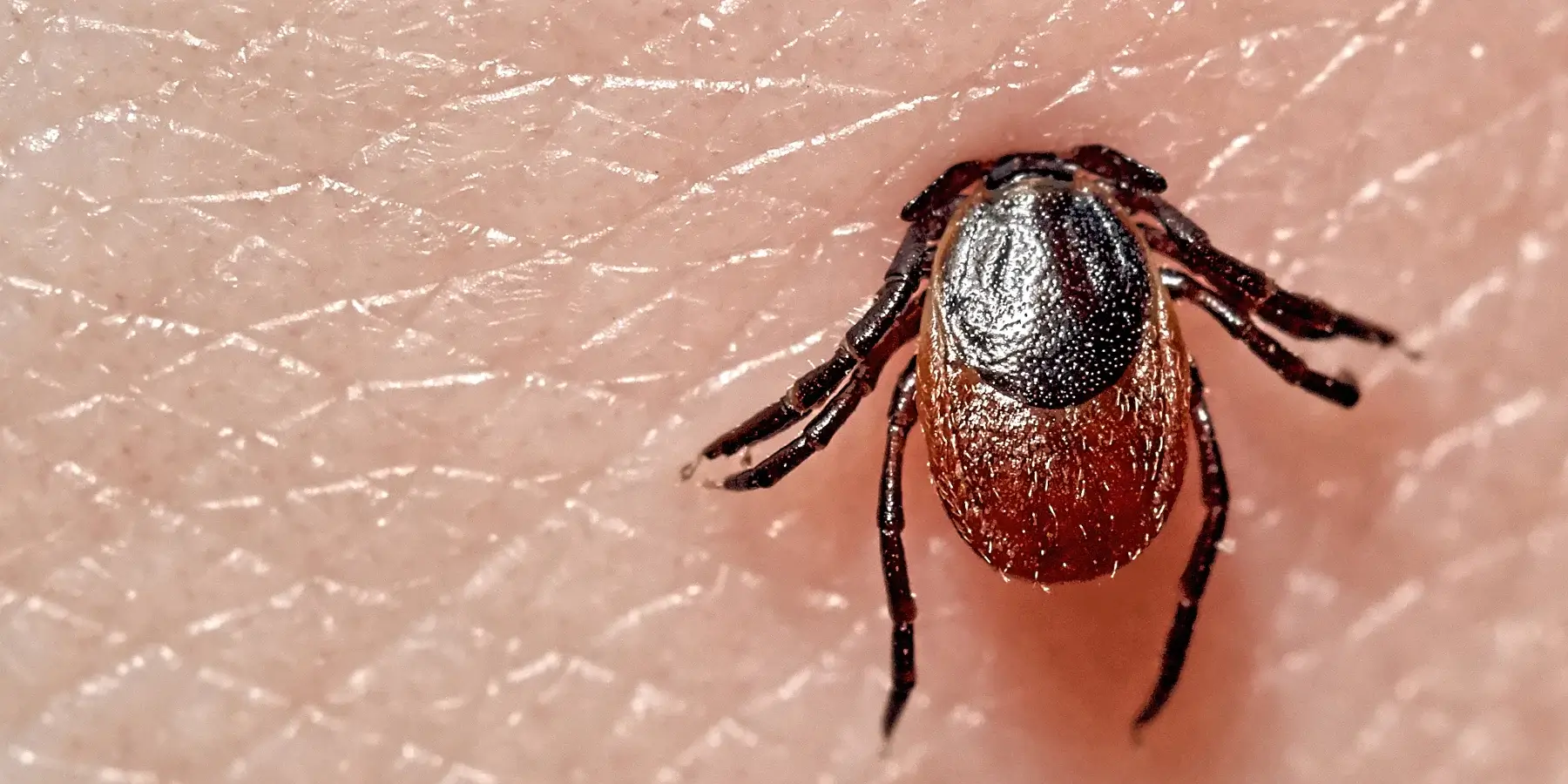 What is Lyme Disease - Early signs and symptoms