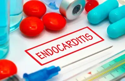 Endocarditis , Myocarditis, Pericarditis and Mitral valve endocarditis (MVE) in Lyme Disease