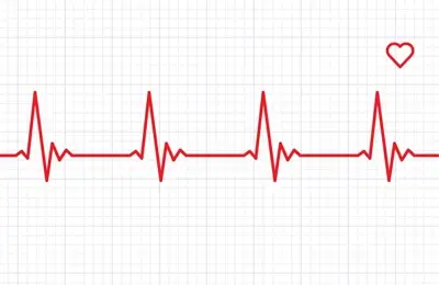 What Is Heart Rate Variability (HRV) And Why Does It Matter?