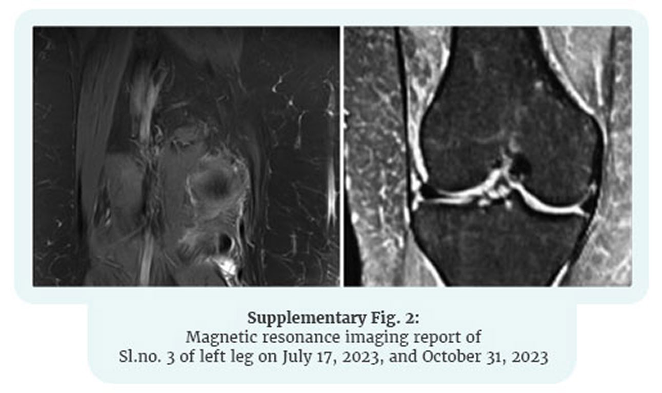 Knee MRI — Week 0 & Week 12 (view 2)