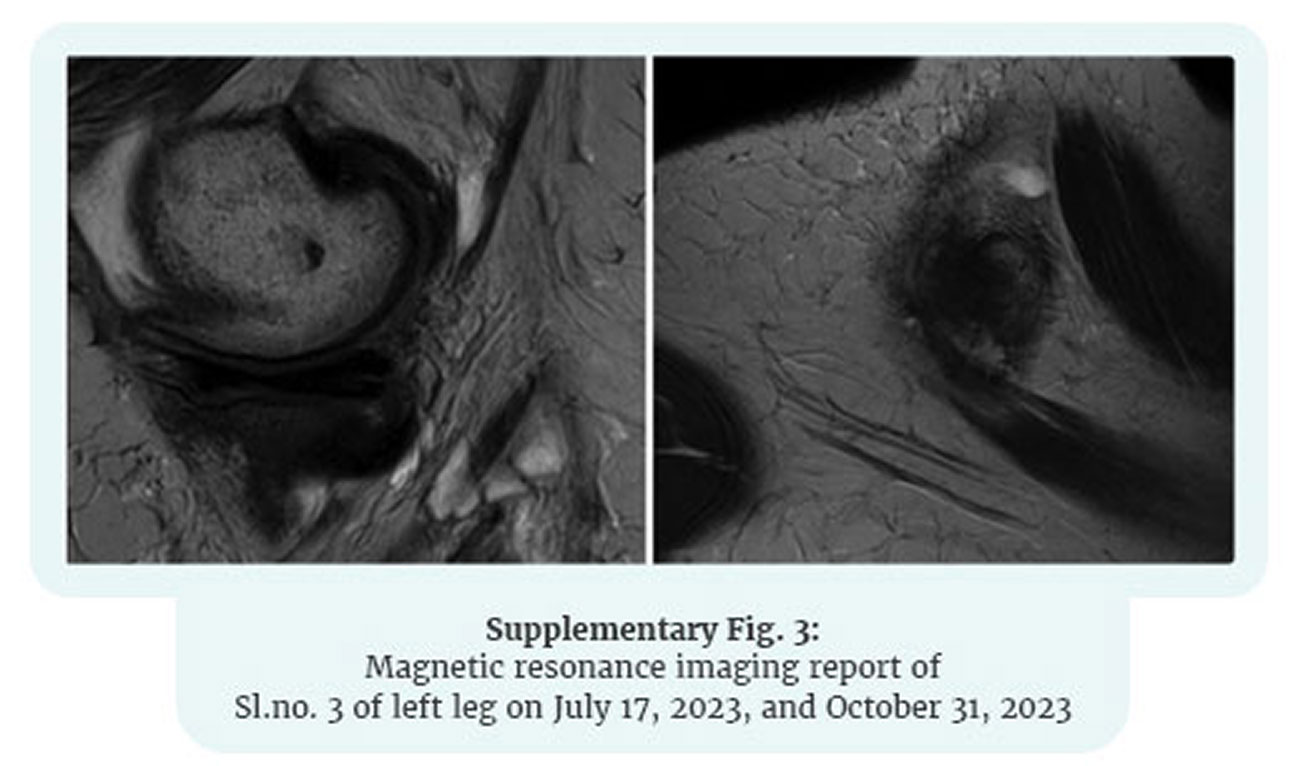 Knee MRI — Week 0 & Week 12 (view 3)