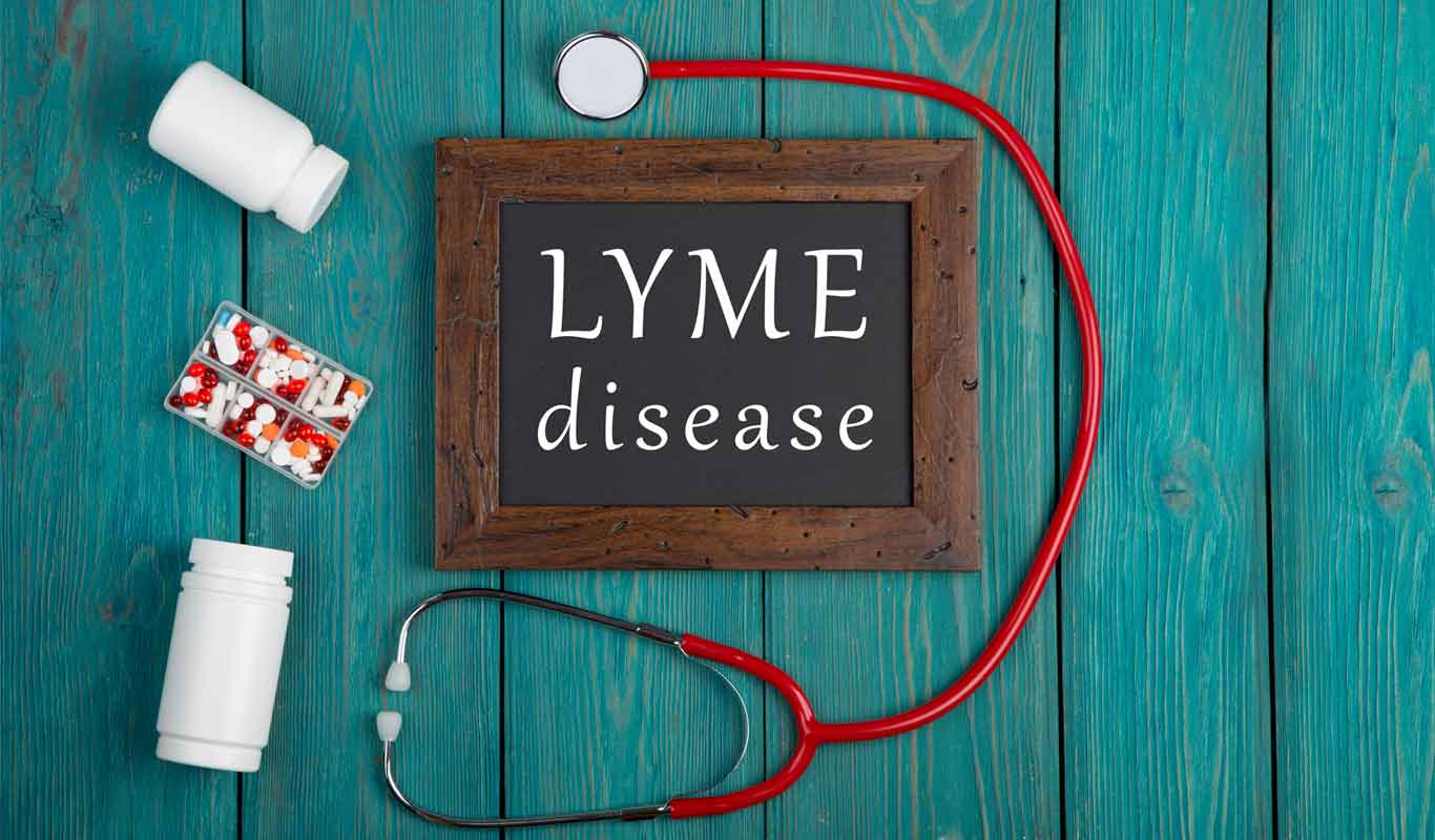 Diagnosis of Lyme Disease