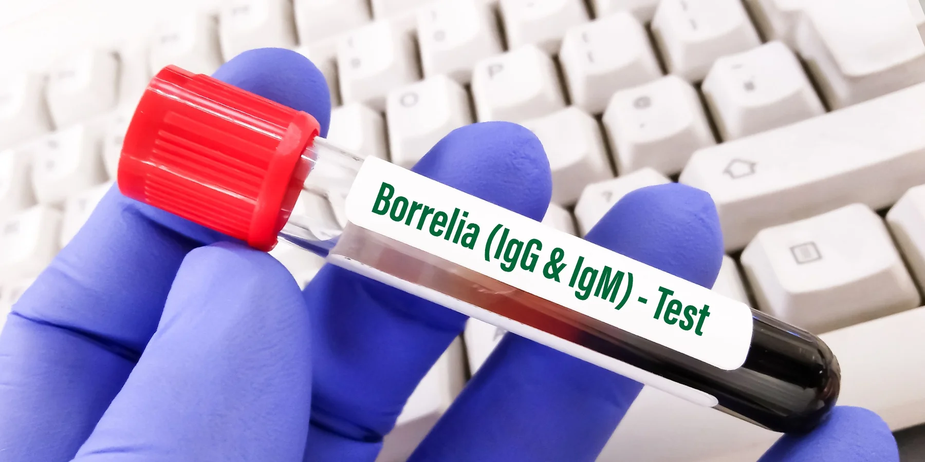 How Accurate are Lyme Disease Tests?